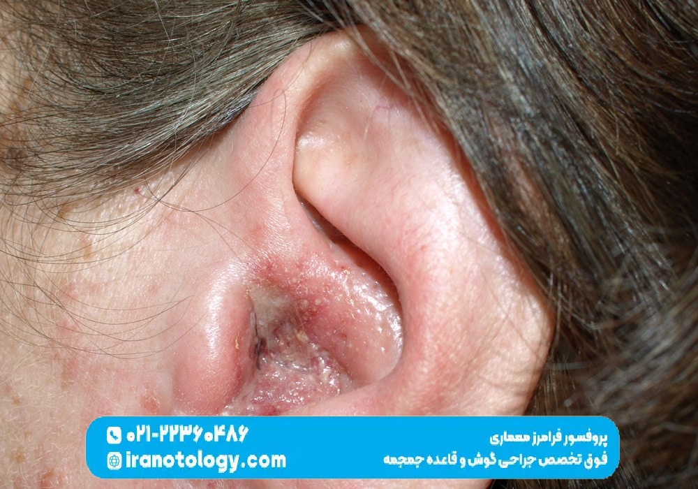 عکس قارچ گوش