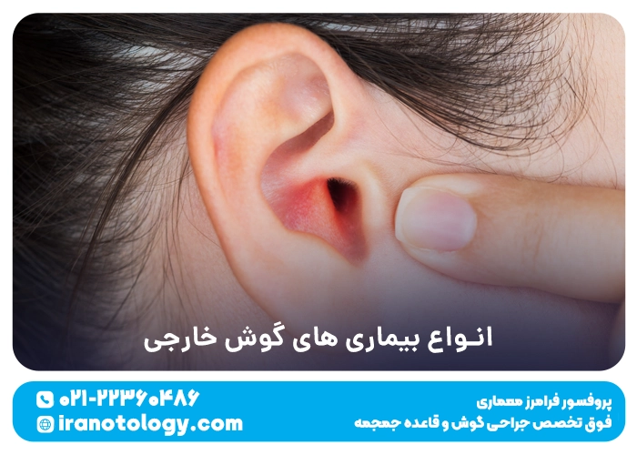 انواع بیماری های گوش خارجی