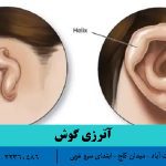 آترزی گوش چیست؟