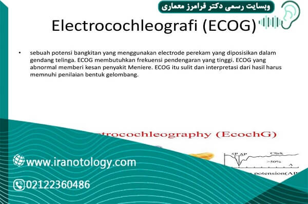-ECOG-یا-الکتروکوکلئوگرافی-چیست-4.jpg