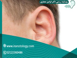 آبسه-لاله-گوش
