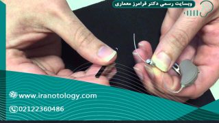 فیلتر سمعک چیست و چه کاربردی دارد؟ 3