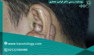 کلوئید-گوش