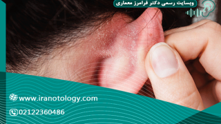 بررسی علل بوی پشت گوش