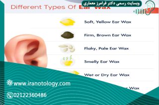 رنگ-جرم-گوش