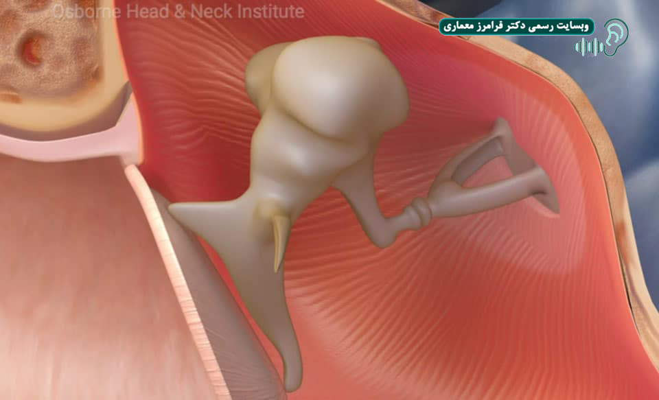گوش چسبنده