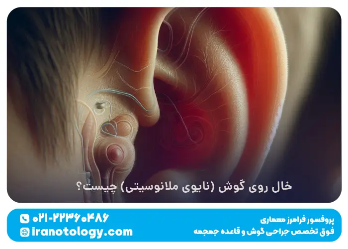 خال روی گوش (نایوی ملانوسیتی) چیست؟