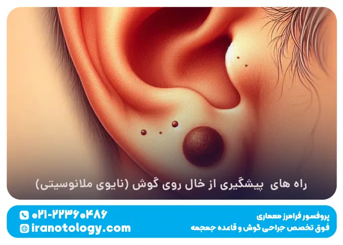 راه های پیشگیری از خال روی گوش (نایوی ملانوسیتی)