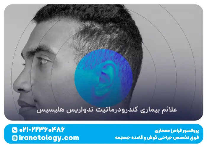 علائم بیماری کندرودرماتیت ندولریس هلیسیس