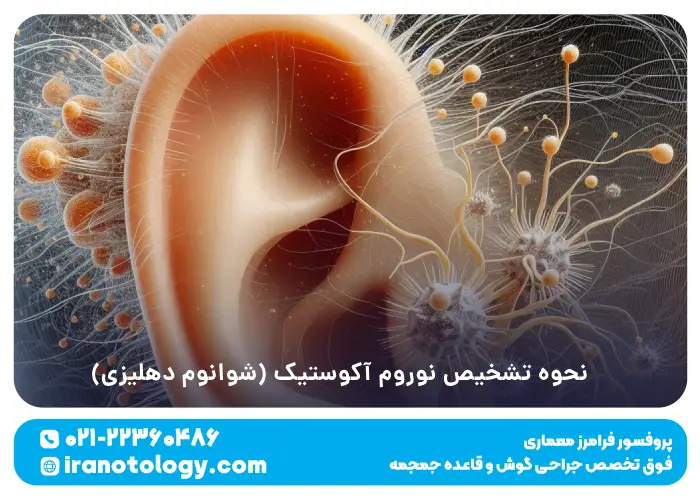 نحوه تشخیص نوروم آکوستیک (شوانوم دهلیزی)