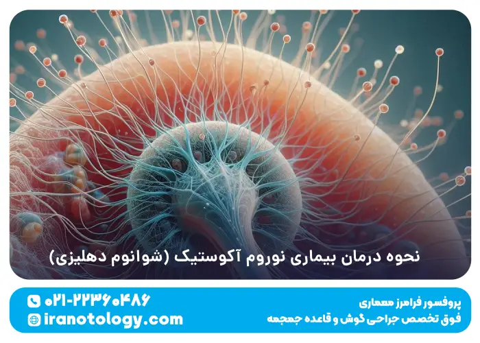 نحوه درمان بیماری نوروم آکوستیک (شوانوم دهلیزی)