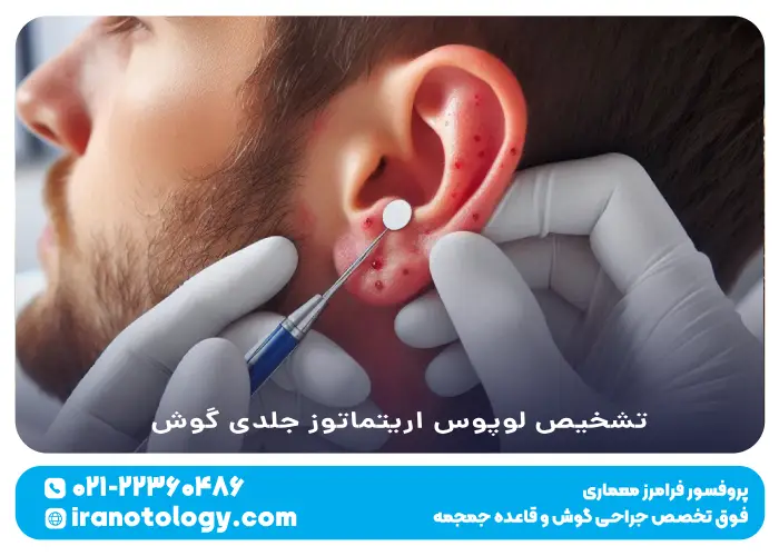 تشخیص لوپوس اریتماتوز جلدی گوش