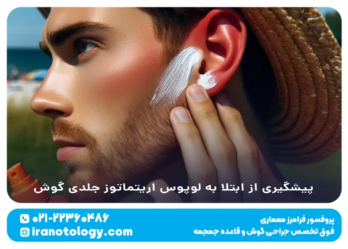روش_های پیشگیری برای ابتلا به لوپوس اریتماتوز جلدی گوش