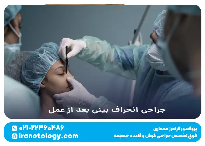 جراحی انحراف بینی بعد از عمل