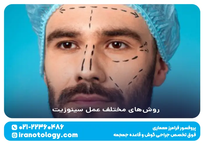 روش_های مختلف عمل سینوزیت