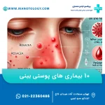 10 بیماری های پوستی بینی
