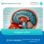 برای درمان سینوزیت چه باید کرد؟