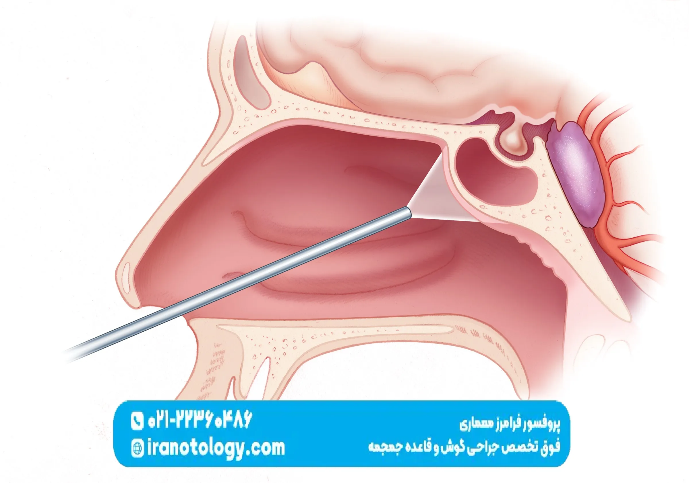 جراحی قاعده جمجمه