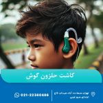 کاشت حلزون گوش