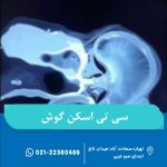 سیتیاسکن گوش