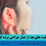 مراقبت های بعد از عمل جراحی پرده گوش