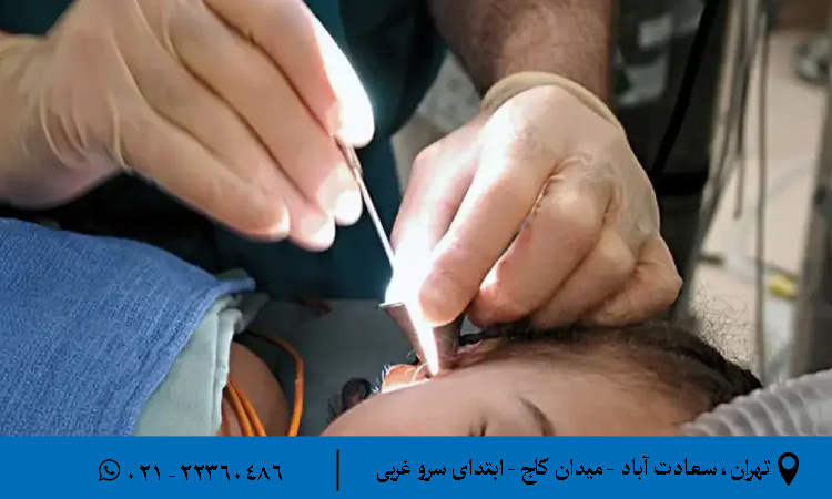 مزایا و معایب جراحی پرده گوش با لیزر
