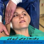 مراقبت بعد از جراحی آترزی گوش