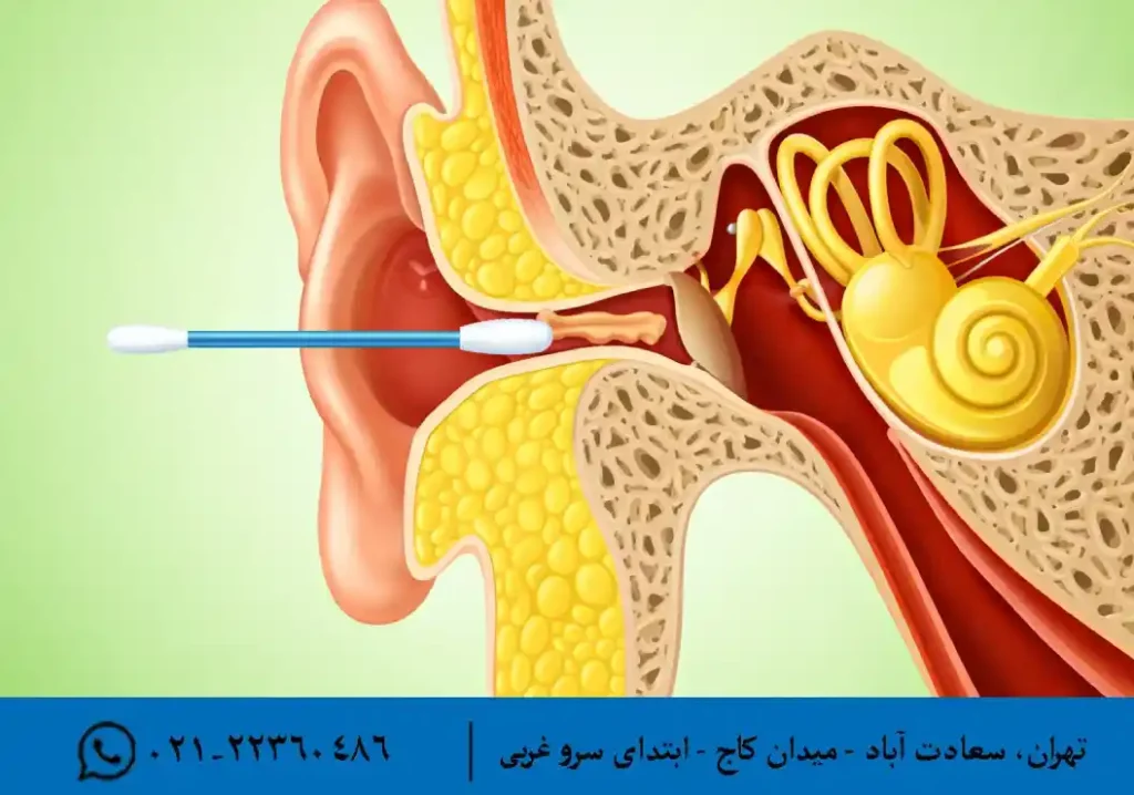 تمیز کاری گوش با گوش پاک کن