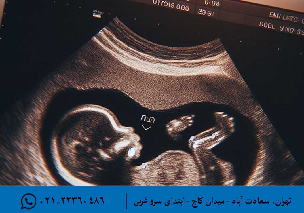 روش های تصویر برداری از جنین